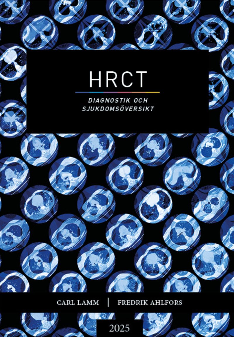 HRCT - diagnostik och sjukdomsöversikt